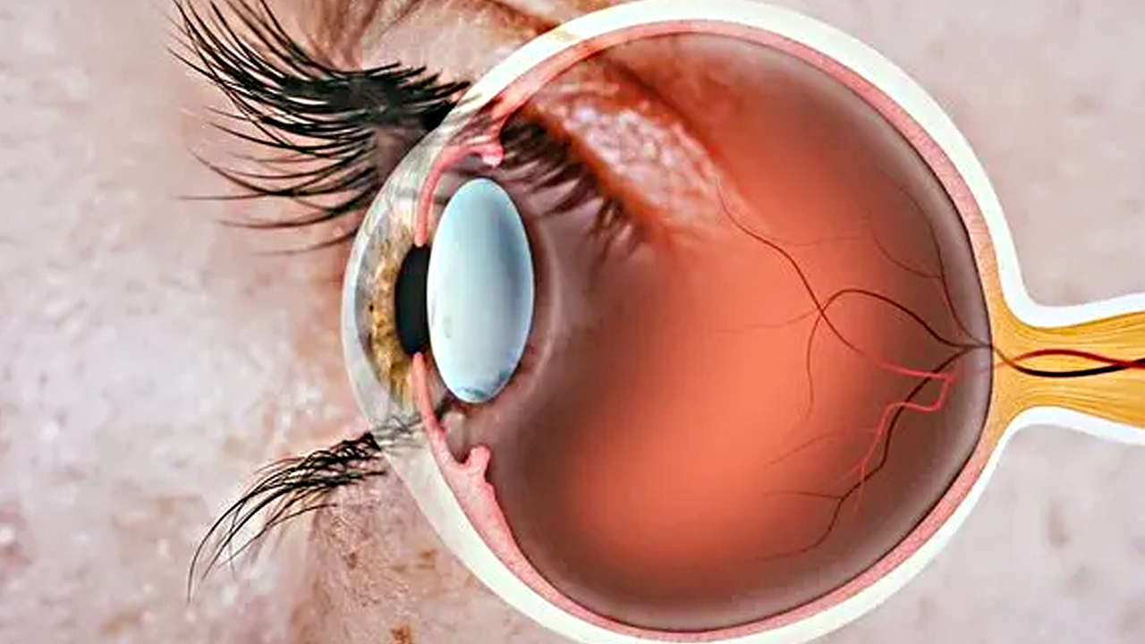 Foto - Körlüğe sürükleyen bu hataya dikkat! Herkes şaşkınlık içinde: Yalnız basit bir göz kızarıklığı demeyin