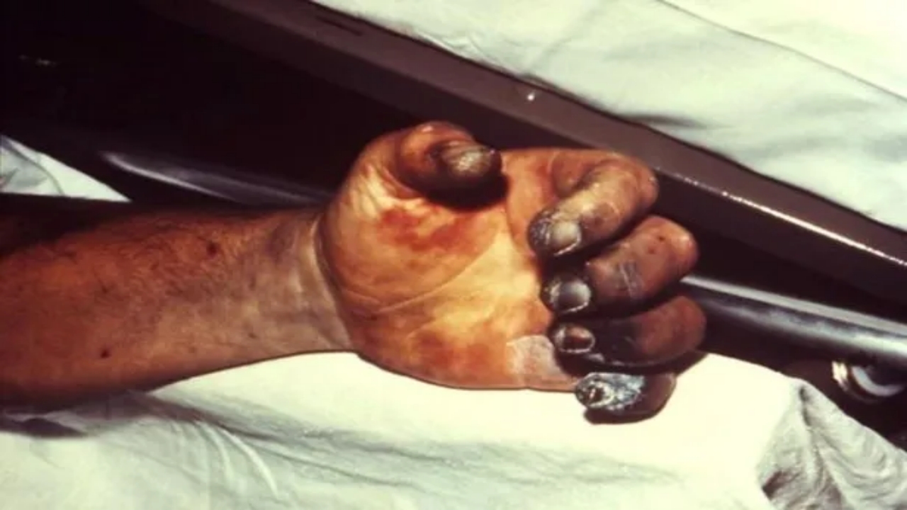 Foto - Korona falan değil! İnsanlık tarihinin en ölümcül hastalığı yeniden hortladı