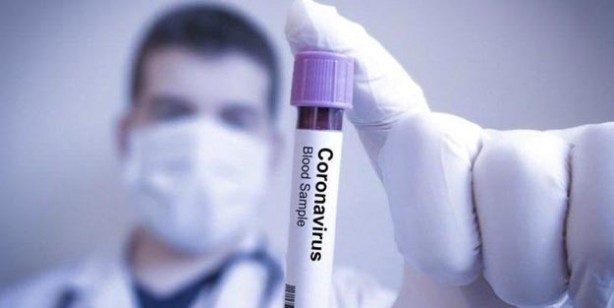 Foto - Korona virüs tespiti nasıl yapılır? Korona virüs (corona virüs) testi nasıl yapılır?