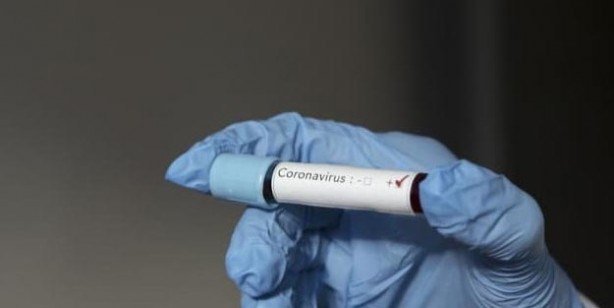 Foto - Korona virüs tespiti nasıl yapılır? Korona virüs (corona virüs) testi nasıl yapılır?