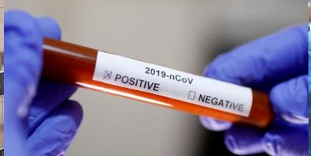 Foto - Korona virüs tespiti nasıl yapılır? Korona virüs (corona virüs) testi nasıl yapılır?