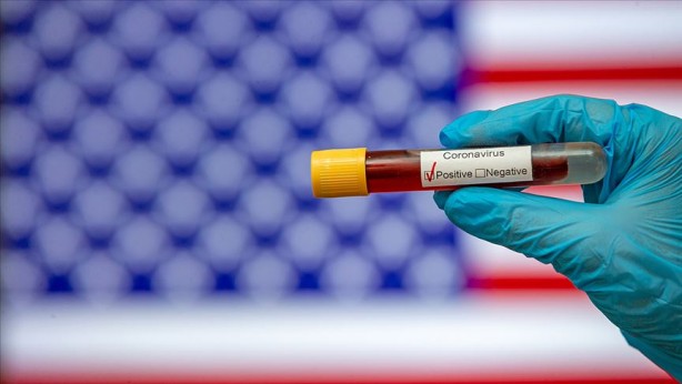 Foto - Koronavirüs ilacı için yeni açıklama! Tarih verdiler