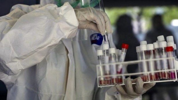 Foto - Koronavirüs aşısında sıcak gelişme! 157 milyon dolarlık dev anlaşmayı duyurdular