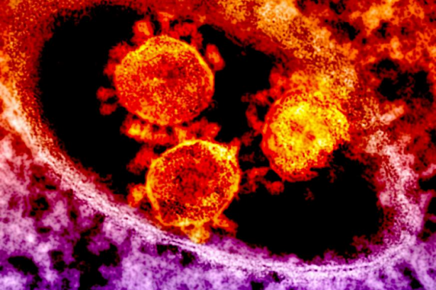 Foto - Koronavirüs dünyayı ele geçiriyor! İşte son durum