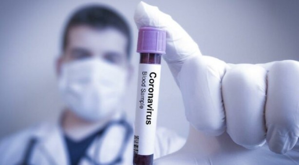 Foto - Koronavirüs için ortalığı ayağa kaldırdılar ama araştırmalar şaşırttı