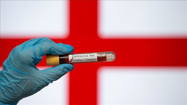 Foto - Koronavirüs ile ilgili çok konuşulacak iddia! Bilim insanları: Kanıtlarımız var