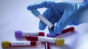 Foto - Koronavirüs konusunda sevindirici gelişme! 'FDA'dan onay aldık' diyerek duyurdular