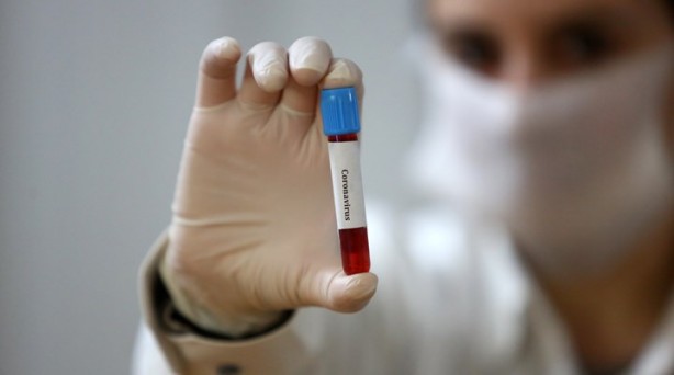 Foto - Koronavirüs konusunda sevindirici gelişme! 'FDA'dan onay aldık' diyerek duyurdular