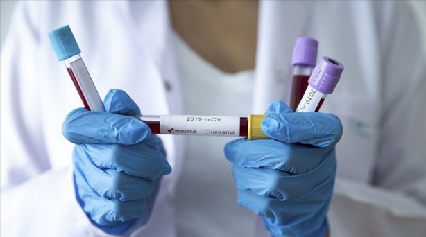 Foto - Koronavirüs yasakları ne zaman kalkacak? Bilim Kurulu üyesi Alpay Azap açıkladı