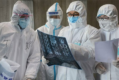 Foto - Koronavirüse dair dikkat çeken araştırma sonuçları! Vakalar bunu yaşamadan önce ortaya çıkıyor