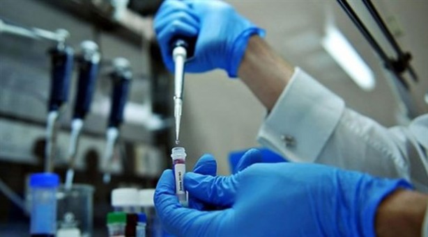 Foto - Koronavirüsle yarışan domuz gribinin 8 belirtisi