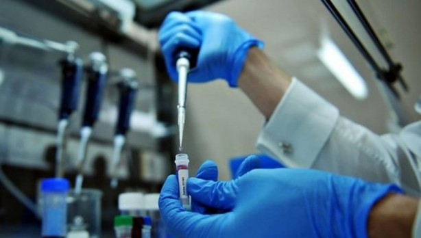 Foto - Koronavirüsle yarışan domuz gribinin 8 belirtisi