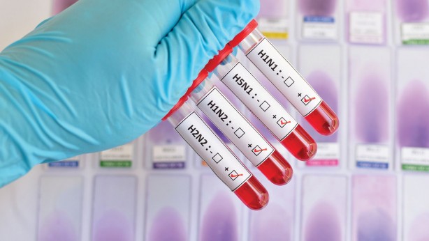 Foto - Koronavirüsle yarışan domuz gribinin 8 belirtisi