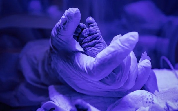 Koronavirüslü çocuklar ilk kez görüntülendi