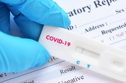 Foto - Koronavirüste önemli gelişme! ABD’li dev şirket denemeye başladıklarını duyurdu