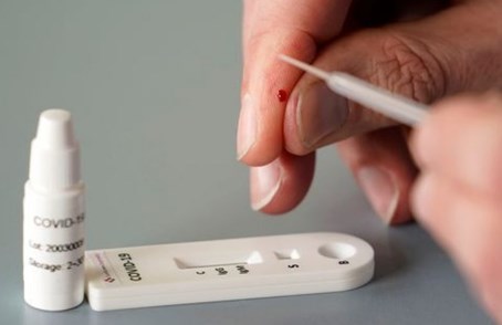 Foto - Koronavirüste önemli gelişme! ABD’li dev şirket denemeye başladıklarını duyurdu