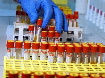 Foto - Koronavirüste önemli gelişme! ABD’li dev şirket denemeye başladıklarını duyurdu