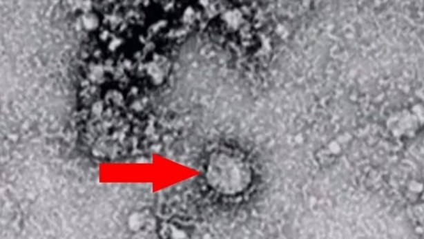 Foto - Koronavirüsten sonra şimdi de Bunyavirüs alarmı! Bunyavirus nedir? Belirtileri nelerdir? 