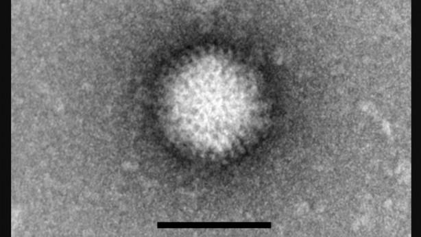 Foto - Koronavirüsten sonra şimdi de Bunyavirüs alarmı! Bunyavirus nedir? Belirtileri nelerdir? 