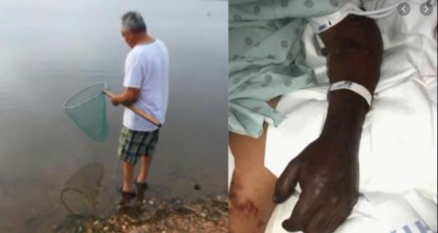 Foto - Koronavirüsten sonra yeni kabus! Bulaştığı insanı 1 hafta içerisinde öldürüyor