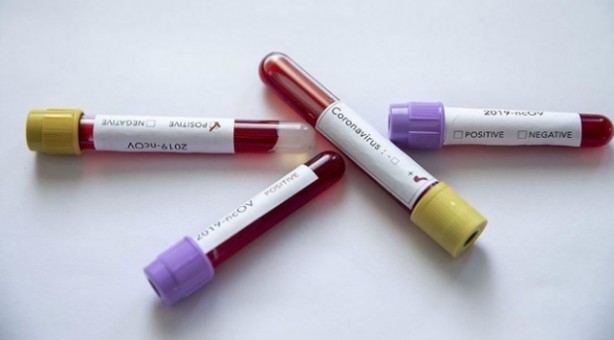 Foto - 'Koronavirüsü yendik' demişlerdi! Son gelişmeler ülkeyi ayağı kaldırdı