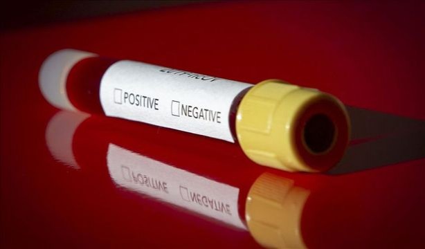 Foto - 'Koronavirüsün ilacını bulduk' diyerek dünyaya duyurmuşlardı! Kötü haber geldi