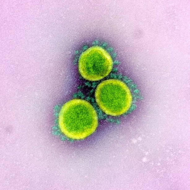 Foto - Koronavirüsün insan hücrelerinde yayılışı görüntülendi! Hızı şaşkınlığa yol açtı