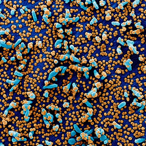 Foto - Koronavirüsün insan hücrelerinde yayılışı görüntülendi! Hızı şaşkınlığa yol açtı