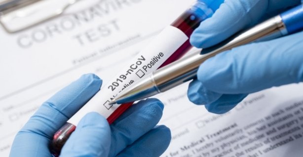 Foto - Koronavirüsün Türkiye'de nasıl yayıldığı ortaya çıktı! ‘Ischgl efekti’