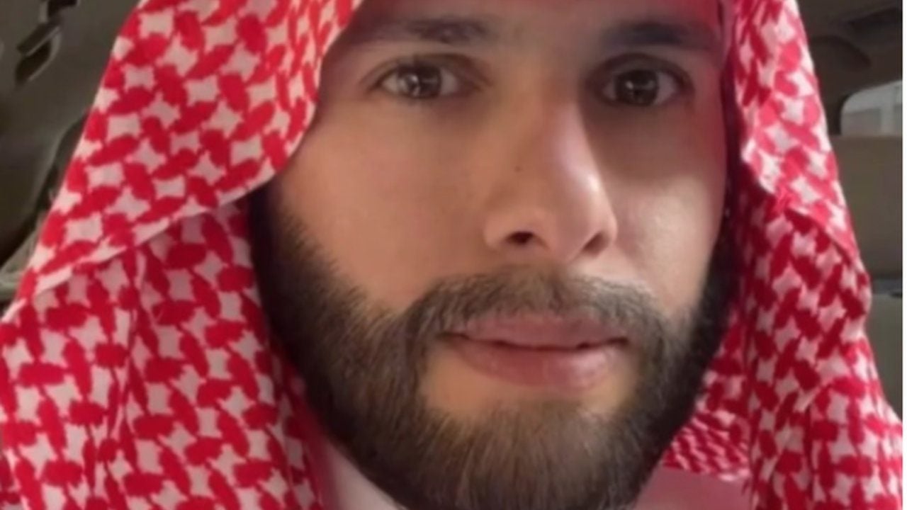 Foto - Köseliği yüzünden alay ediliyordu! Son halini görenler tanıyamıyor