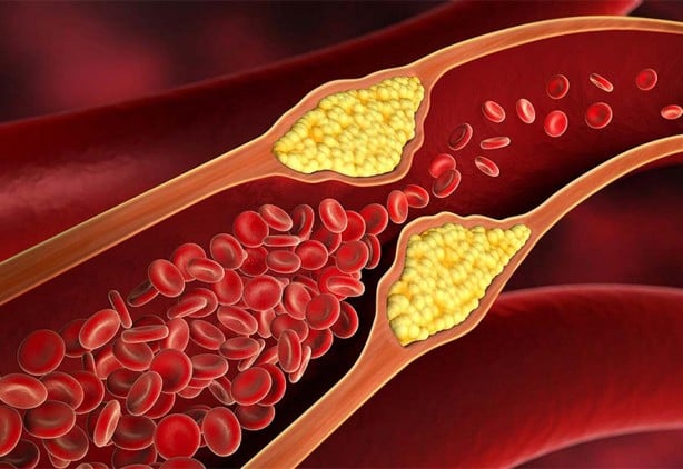Foto - Közlenmiş sarımsak deyip geçmeyin! Bakın tüketince ne oluyor