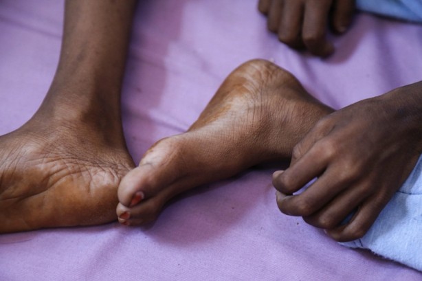 Foto - Kritik uyarı: 400 bin çocuk karşı karşıya