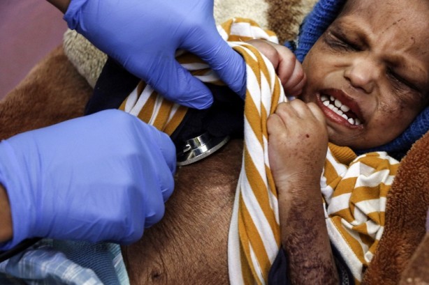 Foto - Kritik uyarı: 400 bin çocuk karşı karşıya