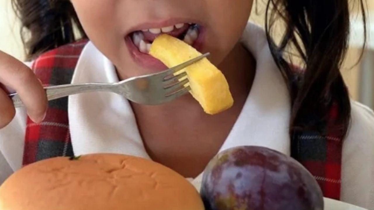 Foto - Kronik ve tekrarlayan bir hastalık... Çocuk ve ergenlerde obezite 34 yılda 4 kat arttı!