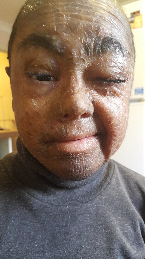 Foto - Küçük çocuk üç yıldır gözlerini kapatamıyor 