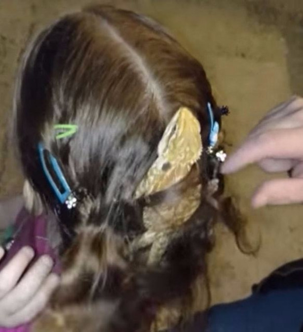 Foto - Küçük kızın kafasından çıkan şey aileyi şoka soktu!