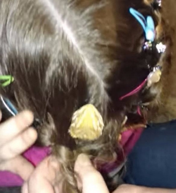 Foto - Küçük kızın kafasından çıkan şey aileyi şoka soktu!