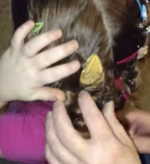 Foto - Küçük kızın kafasından çıkan şey aileyi şoka soktu!