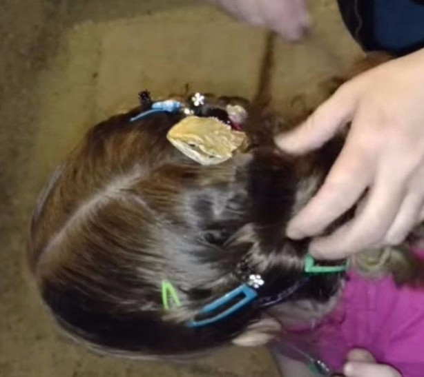 Foto - Küçük kızın kafasından çıkan şey aileyi şoka soktu!