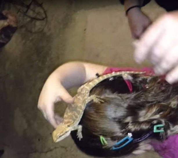 Foto - Küçük kızın kafasından çıkan şey aileyi şoka soktu!