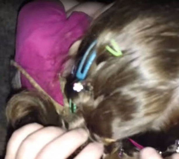  Küçük kızın kafasından çıkan şey aileyi şoka soktu!