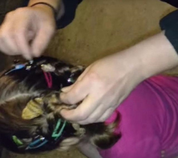 Foto - Küçük kızın kafasından çıkan şey aileyi şoka soktu!