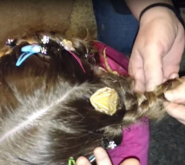 Foto - Küçük kızın kafasından çıkan şey aileyi şoka soktu!