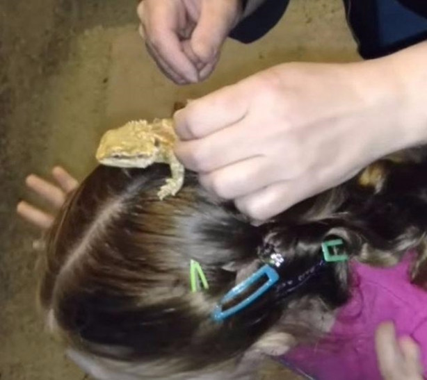 Foto - Küçük kızın kafasından çıkan şey aileyi şoka soktu!