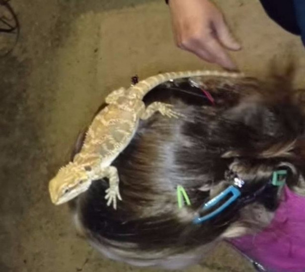 Foto - Küçük kızın kafasından çıkan şey aileyi şoka soktu!