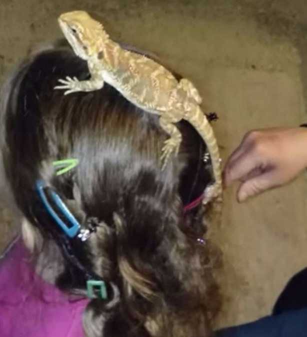 Foto - Küçük kızın kafasından çıkan şey aileyi şoka soktu!