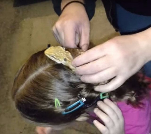 Foto - Küçük kızın kafasından çıkan şey aileyi şoka soktu!