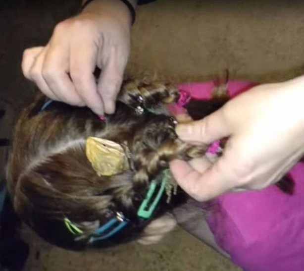 Foto - Küçük kızın kafasından çıkan şey aileyi şoka soktu!