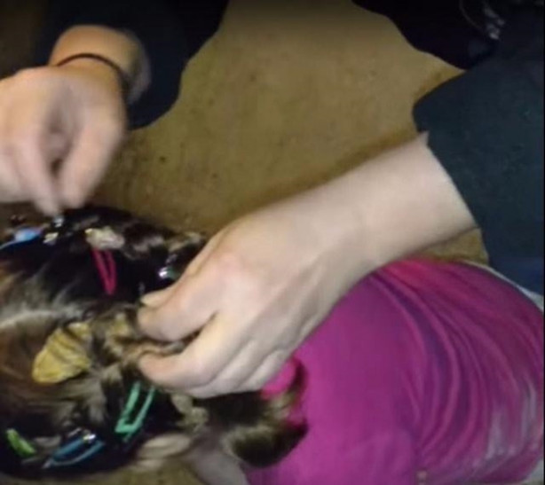 Foto - Küçük kızın kafasından çıkan şey aileyi şoka soktu!