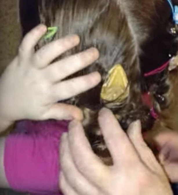 Foto - Küçük kızın kafasından çıkan şey aileyi şoka soktu!